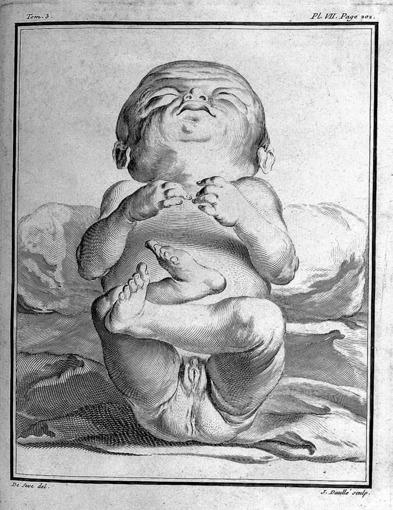 Radierung eines Babys. Aus: Buffons Histoire naturelle, générale et particuliére (Bild: Wellcome Library, London) 
